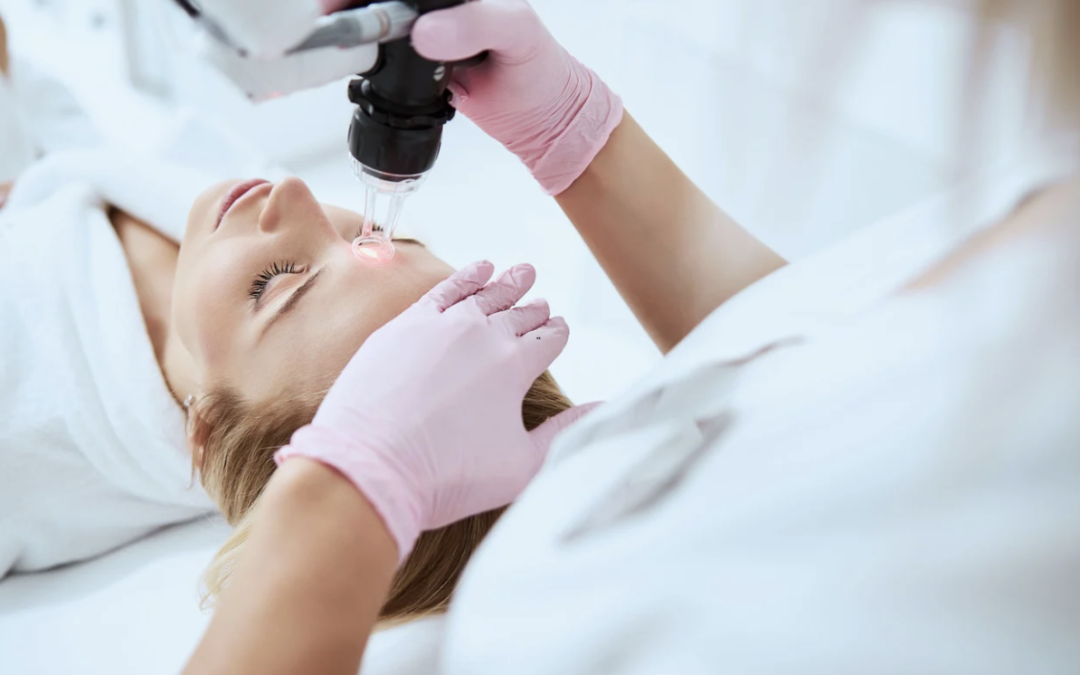 Laser Resurfacing Consultation Near Chevy Chase, Maryland